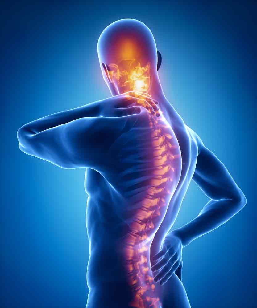 Facet Joint Pain