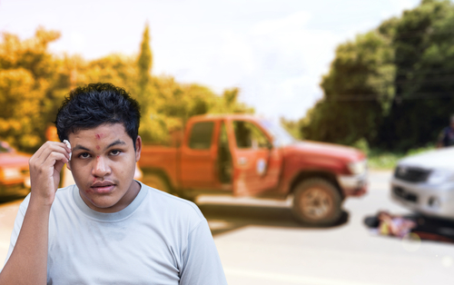 3 common car accident-related face injuries shutterstock 594651215 3 common car accident-related face injuries