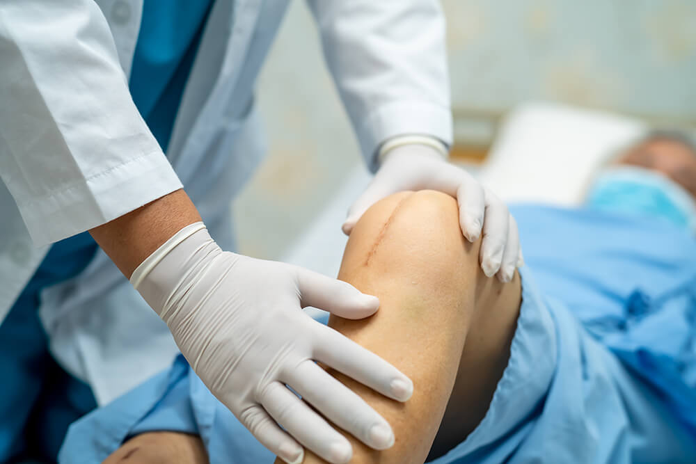 How long after a knee replacement should you wait to start PT?